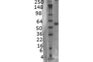 Western blot detection of VACHT on rat membrane tissues using a 1:1000 dilution of SLC18A3 / VACHT Cat. (SLC18A3 antibody  (AA 521-532))