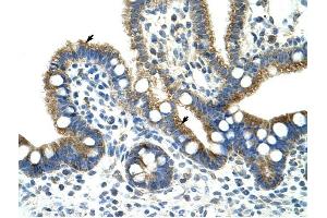 Copine I antibody was used for immunohistochemistry at a concentration of 4-8 ug/ml to stain Epithelial cells of intestinal villus (arrows) in Human Intestine . (CPNE1 antibody  (N-Term))
