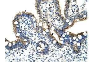 Copine I antibody was used for immunohistochemistry at a concentration of 4-8 ug/ml to stain Epithelial cells of intestinal villus (arrows) in Human Intestine .