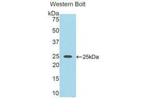 Western Blotting (WB) image for anti-Nexilin (NEXN) (AA 409-605) antibody (ABIN1859994) (NEXN antibody  (AA 409-605))