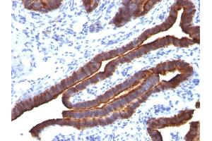 Immunohistochemistry (IHC) image for anti-Mucin 1 (MUC1) antibody (ABIN6940099)