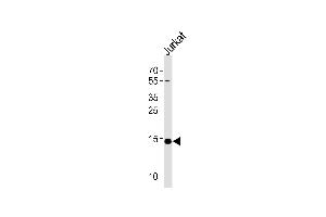 Western blot analysis of lysate from Jurkat cell line, using UBE2D4 Antibody (C-term) (ABIN1536656 and ABIN2838106).
