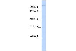 WB Suggested Anti-TXNDC16 Antibody Titration:  0. (TXNDC16 antibody  (N-Term))