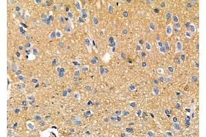 ABIN6257800 and ABIN6273894 at 1/100 staining Rat brain tissue by IHC-P. (NPBWR2 antibody  (C-Term))