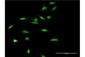 Immunofluorescence of monoclonal antibody to SMARCA5 on HeLa cell. (SMARCA5 antibody  (AA 59-147))