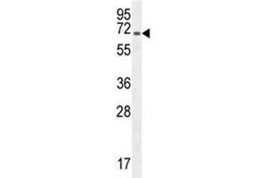 Western Blotting (WB) image for anti-Platelet/endothelial Cell Adhesion Molecule (PECAM1) (AA 508-536) antibody (ABIN3032259)