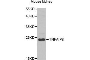 Western blot analysis of extracts of mouse kidney, using TNFAIP8 antibody (ABIN5974482) at 1/1000 dilution. (TNFAIP8 antibody)