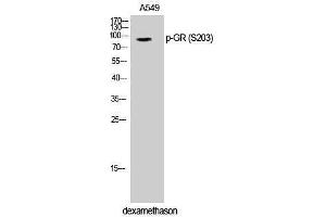 Western Blotting (WB) image for anti-GR (pSer203) antibody (ABIN3173074) (GR (pSer203) antibody)