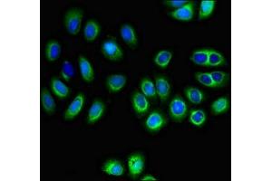 Immunofluorescent analysis of A549 cells using ABIN7160169 at dilution of 1:100 and Alexa Fluor 488-congugated AffiniPure Goat Anti-Rabbit IgG(H+L) (MCT3 antibody  (AA 432-504))