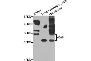 Western blot analysis of extracts of various cell lines, using CA8 antibody (ABIN5975602) at 1/1000 dilution. (CA8 antibody)