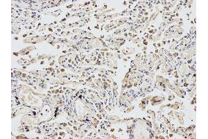 Immunohistochemistry (IHC) image for anti-Eukaryotic Translation Initiation Factor 4A2 (EIF4A2) antibody (ABIN1876482) (EIF4A2 antibody)