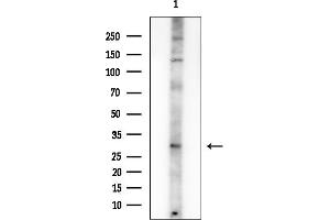anti-Peroxisomal Biogenesis Factor 2 (PEX2) (Internal Region) antibody