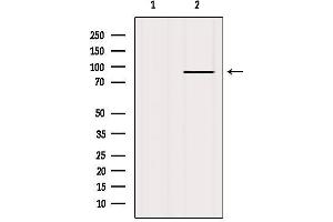 Western blot analysis of extracts from HepG2, using FGFR2 Antibody. (FGFR2 antibody  (C-Term))