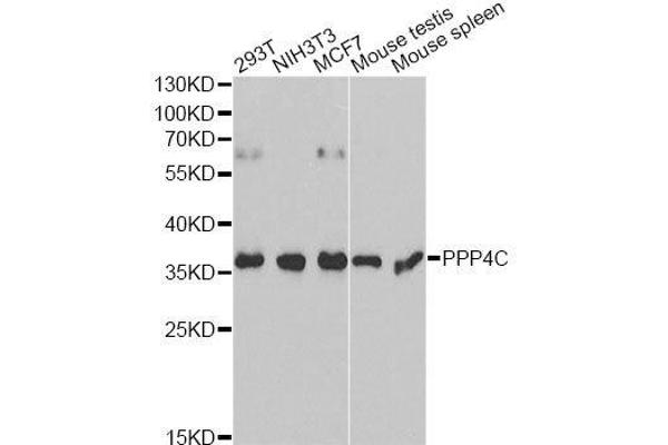 PPP4C antibody  (AA 1-307)