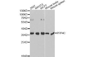 Western blot analysis of extracts of various cell lines, using PPP4C antibody. (PPP4C antibody  (AA 1-307))