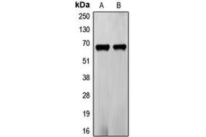 Western blot analysis of Frizzled 5 expression in PC3 (A), LOVO (B) whole cell lysates. (FZD5 antibody  (C-Term))
