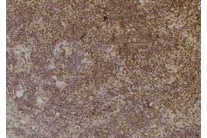 ABIN6257013 and ABIN6274965 at 1/100 staining Mouse spleen tissue by IHC-P.