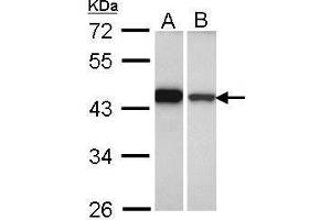 WB Image Sample (30 ug of whole cell lysate) A: A431 , B: Hela 10% SDS PAGE antibody diluted at 1:1000 (GIPC1 antibody  (C-Term))