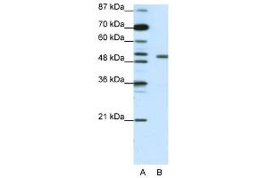 KCNAB2 antibody used at 1. (KCNAB2 antibody  (Middle Region))