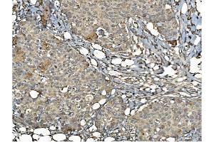 IHC analysis of PDIA6 using anti-PDIA6 antibody (ABIN7600553). (PDIA6 antibody  (AA 20-440))