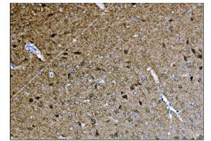 IHC analysis of CAMKIV/Camk4 using anti-CAMKIV/Camk4 antibody (ABIN7600419). (CAMK4 antibody  (AA 19-469))