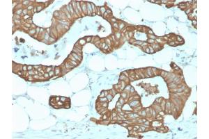 Formalin-fixed, paraffin-embedded human Colon stained with Cytokeratin 19 Rabbit Recombinant Monoclonal Antibody (KRT19/1959R). (Recombinant Cytokeratin 19 antibody)