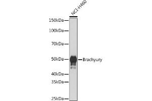 Western blot analysis of extracts of NCI-H460 cells, using Brachyury Rabbit mAb (ABIN1682626, ABIN3019362, ABIN3019363 and ABIN7101757) at 1:1000 dilution. (Scinderin antibody)