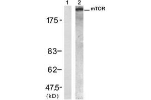 Western blot analysis of extract from 293 cell, using mTOR (Ab-2448) Antibody (E021214, Lane 1 and 2). (MTOR antibody)