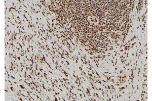 ABIN6275851 at 1/100 staining Human gastric tissue by IHC-P.