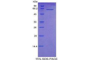 SDS-PAGE (SDS) image for Calmodulin 1 (Calm1) (AA 1-149) protein (His tag,MBP tag) (ABIN1821721)