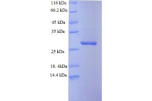 SDS-PAGE (SDS) image for SAM Domain and HD Domain 1 (SAMHD1) (AA 395-626) protein (His tag) (ABIN5710314) (SAMHD1 Protein (AA 395-626) (His tag))