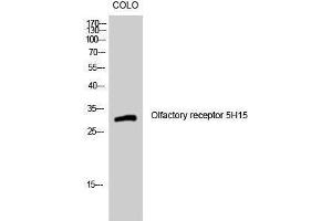 Western Blotting (WB) image for anti-Olfactory Receptor, Family 5, Subfamily H, Member 15 (OR5H15) (C-Term) antibody (ABIN3186156) (OR5H15 antibody  (C-Term))