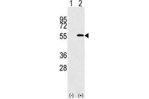 Western blot analysis of NUP50 antibody and 293 cell lysate (2 ug/lane) either nontransfected (Lane 1) or transiently transfected with the NUP50 gene (2). (NUP50 antibody  (AA 432-461))