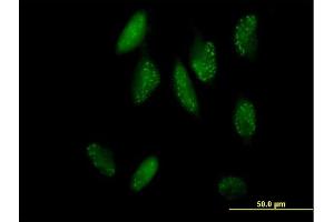 Immunofluorescence of purified MaxPab antibody to SH2B on HeLa cell. (SH2B1 antibody  (AA 1-426))
