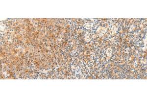 Immunohistochemistry of paraffin-embedded Human tonsil tissue using RAPGEF1 Polyclonal Antibody at dilution of 1:45(x200) (GRF2 antibody)