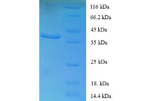 SDS-PAGE (SDS) image for Forkhead Box P1 (FOXP1) (AA 1-114), (partial) protein (GST tag) (ABIN4976382)
