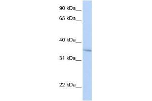 FHL3 antibody used at 0. (FHL3 antibody  (Middle Region))