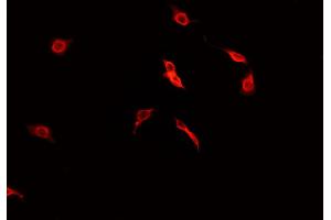 ABIN6269031 staining CACO-2 cells by IF/ICC. (PDGFRA antibody  (C-Term))