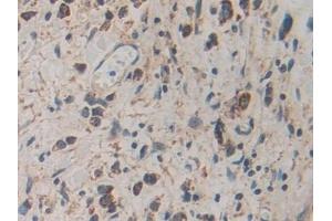Immunohistochemistry (IHC) image for anti-Calcyclin Binding Protein (CACYBP) (AA 2-228) antibody (ABIN7434842)