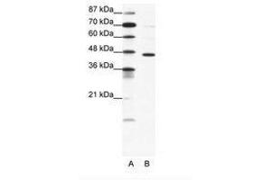Image no. 1 for anti-gamma-aminobutyric Acid (GABA) A Receptor, pi (GABRP) (AA 28-77) antibody (ABIN202529)