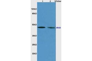 L1 human colon carcinoma lysates L2 rat brain lysates probed with Anti ICAD/DFF-45 Beta Polyclonal Antibody, Unconjugated (ABIN726380) at 1:200 overnight at 4 °C. (DFFA antibody  (AA 2-100))