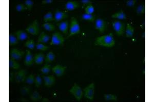 Immunofluorescence staining of Hela cells with ABIN7146194 at 1:100, counter-stained with DAPI. (E-cadherin antibody  (AA 155-707))