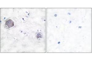 Immunohistochemistry analysis of paraffin-embedded human brain tissue, using Notch 1 (Cleaved-Val1754) Antibody. (Notch1 antibody  (Cleaved-Val1754))