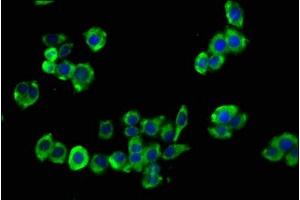 Immunofluorescence staining of PC-3 cells with ABIN7153687 at 1:133, counter-stained with DAPI. (CCKBR antibody  (AA 243-333))