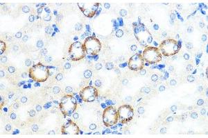 Immunohistochemistry of paraffin-embedded Mouse kidney using NOD1 Polyclonal Antibody at dilution of 1:100 (40x lens). (NOD1 antibody)