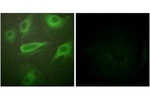 Immunofluorescence analysis of HeLa cells, using IL-4R/CD124 (Phospho-Tyr497) Antibody. (IL4 Receptor antibody  (pTyr497))