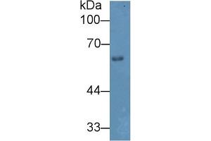 Detection of HPSE in Mouse Skin lysate using Polyclonal Antibody to Heparanase (HPSE) (HPSE antibody  (AA 353-464))