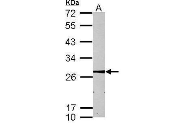 MMAB antibody  (Center)