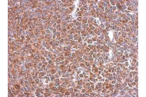 IHC-P Image Immunohistochemical analysis of paraffin-embedded BT483 xenograft, using STIP1, antibody at 1:500 dilution. (STIP1 antibody)