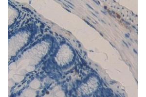 Detection of DLD in Mouse Colon Tissue using Polyclonal Antibody to Dihydrolipoyl Dehydrogenase (DLD)